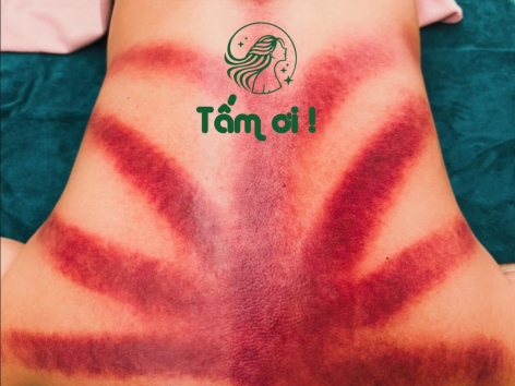 TRẢI NGHIỆM DỊCH VỤ MASSAGE BODY TRỊ LIỆU TẠI TẤM ƠI